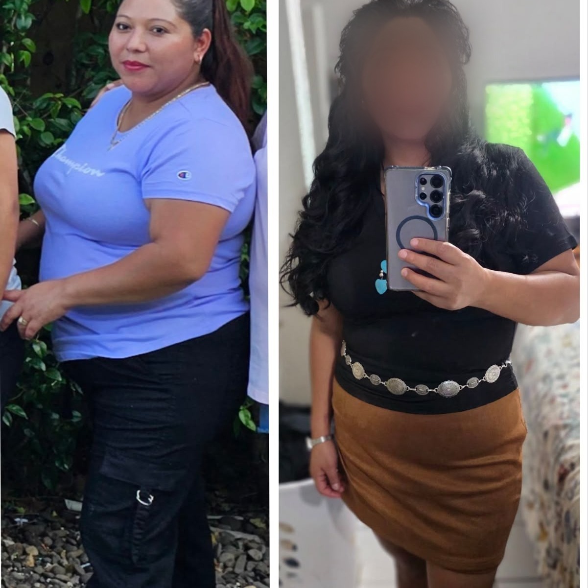 Patient physique transformation under the BodDoc optimization program (face blurred for privacy)